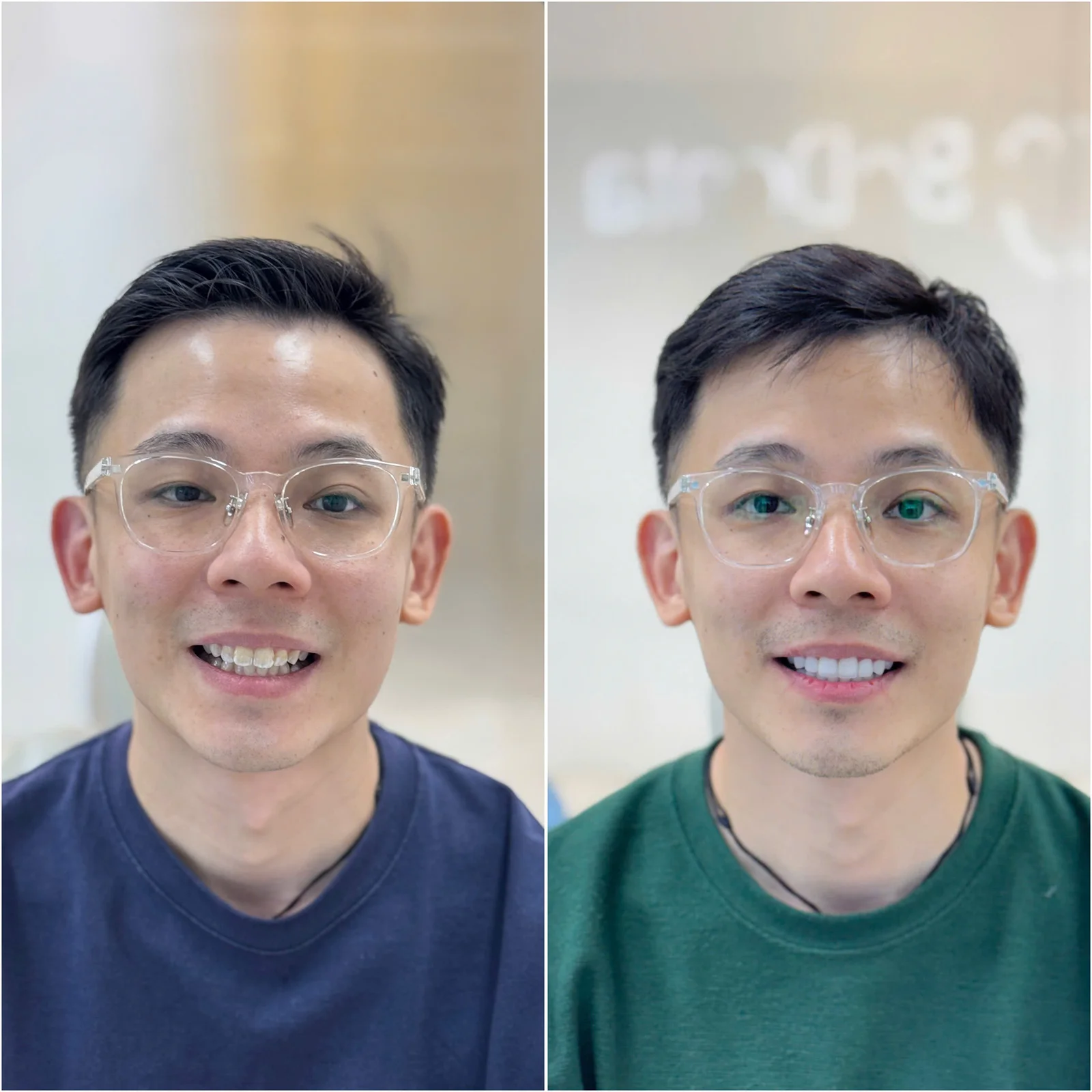 Customer dental treatment comparison 1